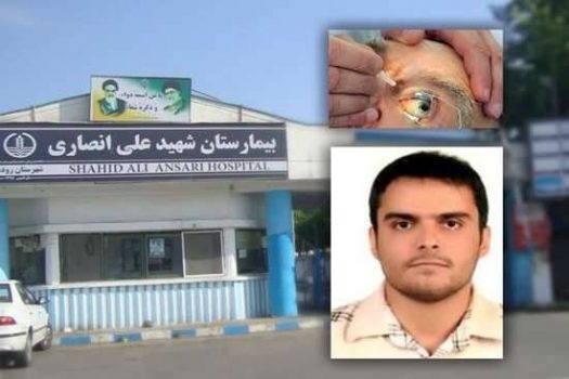 اولین عمل جراحی لیزری چشم و تزریق داخل چشمی آواستین در بیمارستان شهید انصاری رودسر اولین عمل جراحی لیزری چشم و تزریق داخل چشمی آواستین در بیمارستان شهید انصاری رودسر