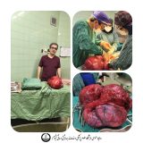 خارج کردن توده سنگین از شکم بیمار پس از سال‌ها درد