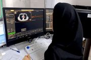 نبض درمان بیماری‌های قلبی شمال کشور در حشمت می‌تپد